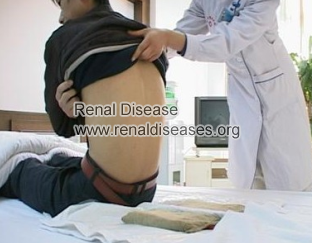 Micro-Chinese Medicine Osmotherapy in Kidney Disease Hospital