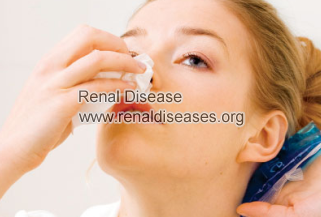  Is A Continuous Nosebleed Symptom of Kidney Failure