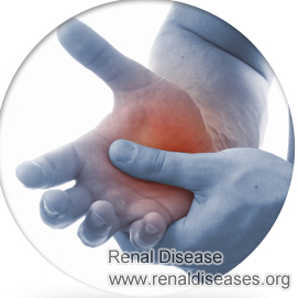 How Does Hydronephrosis Cause Numbness and Pain