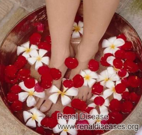 Treatment for Stage 3 Kidney Disease in China