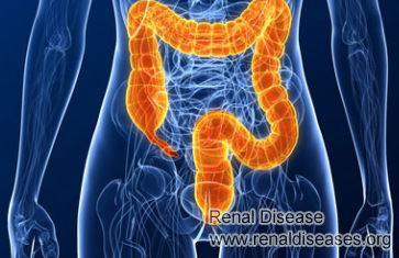 One of “Seven Therapies”-Enema Therapy Works on Kidney Disease