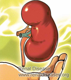 Second Kidney Transplant for Kidney Failure Patients