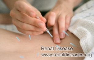 What Happens When Kidney Cyst is 5.2cm