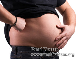 Can Cysts Cause Swollen Kidney for PKD patients