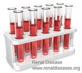 Is There Any Possibility That High Creatinine Level Is 5.5 But Kidney Function Is Normal