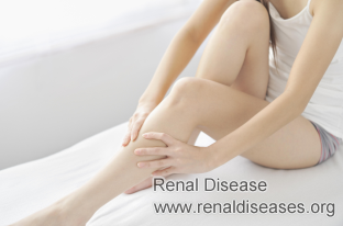 How to Deal With Leg Pain in Kidney Cysts