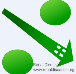 How to Bring Down High Creatinine Naturally