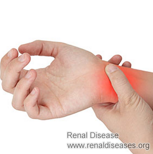 How to Does Swelling and Pain on Wrist Occur in Kidney Disease
