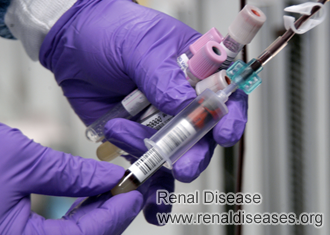 Creatinine Level Rises from 1.5 to 3.67: How to Lower It