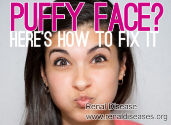 Why Is Face Puffy in CKD Stage 3B