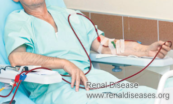 What Will Happen When Dialysis Fails