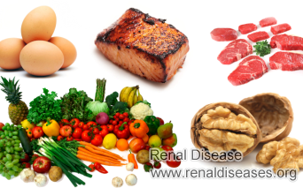 Dietary Restrictions for Polycystic Kidney Disease (PKD)