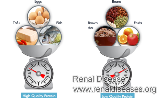Diet Chart for End Stage Renal Disease
