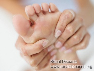 IgA Nephropathy and Gout: Causes and Treatment