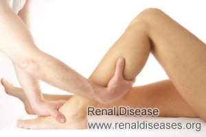 Cramping in the Legs for Kidney Transplant Patients