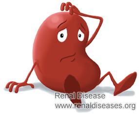 Is Kidney Transplant a Must for Kidney Failure