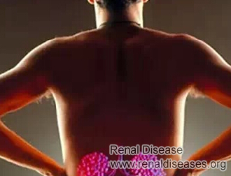 How to Care Your Kidneys at Home 