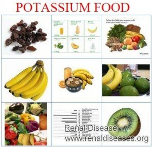 Diet Chart to Reduce Potassium for CKD Stage 5