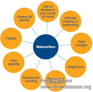 Prevalence of Malnutrition in CKD Patients