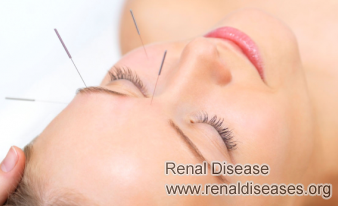 How to Treat Nocturia Naturally for Kidney Failure patients