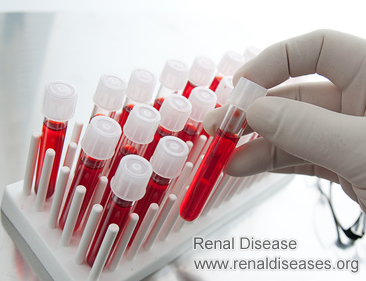 Does Creatinine Rise During or After Dialysis