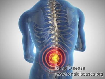 Can Renal Cysts Cause Burning Back Pain
