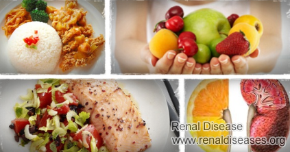 Diet to Follow for Patients with Polycystic Kidney Disease (PKD)