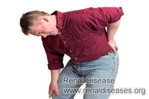 Cysts Burst in Polycystic Kidney Disease: Causes and Symptoms