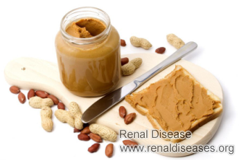 Can I Eat Peanut Butter with Stage 3 CKD