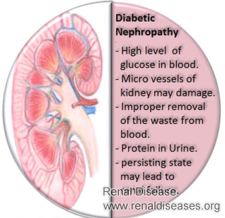 Care Plan or Interventions of Diabetic Nephropathy