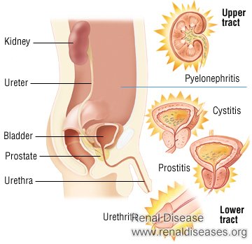What Is the Specific Damage That Can Be Done to the Kidneys