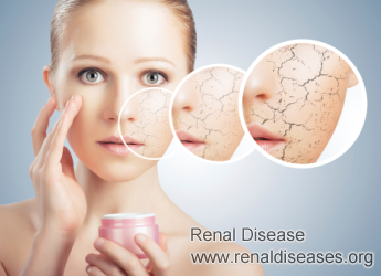 Is It Fine to Use Bleaching Creams and Toner If I Have Inflamed Kidney