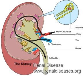 Treatment for Renal Parenchymal Changes Grade 2