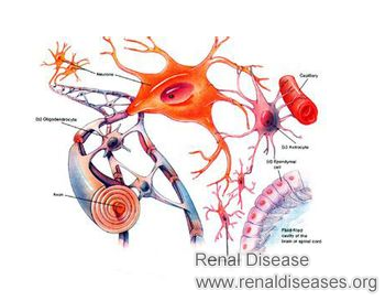 How to Improve 16% Kidney Function for Stage 4 CKD