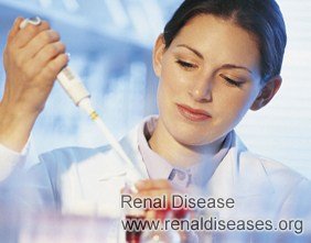 How to Lower 7.2 Creatininie for Diabetes Nephropathy Patients