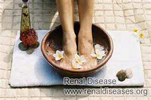 How is Creatinine Level indicative of Kidney pro0blems