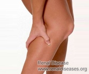 Does Swelling Always Mean Chronic Kidney Disease