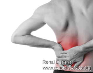 IgA Nephropathy Stage 4 Patients and Lower Back Pain