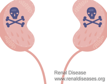 What Does It Mean to Have Poor Appetite and Hiccups After Kidney Transplant