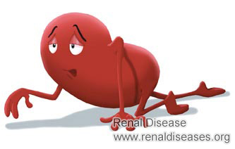 What Are the Symptoms of Shrinking of Kidney