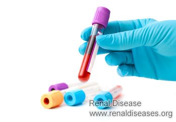 Treatment for High Creatinine Levels in Blood