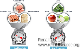 What Food Should A Person with Kidney Disease Avoid