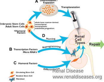 How Can We Increase GFR for Chronic Kidney Disease Patients