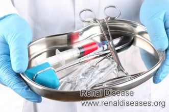 Should I Do Surgery When Largest Cyst Is 4cm in Polycystic Kidney Disease