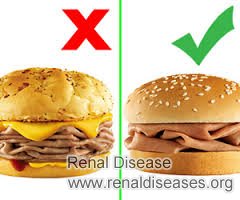 What Fast Food Are OK to Eat with PKD