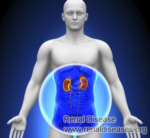 Does Cortical Cyst 7cm on Right Kidney Need a Treatment