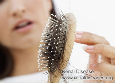 Is Hair Loss A Side Effect of Dialysis and How to Treat