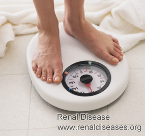 Weight Loss + Long-term Dialysis: Causes and Treatments 