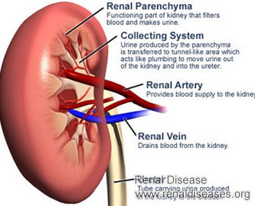 How Can I Treat Renal Parenchymal Disease