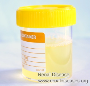 Proteinuria Treatment for Patients with Diabetic Nephroapthy